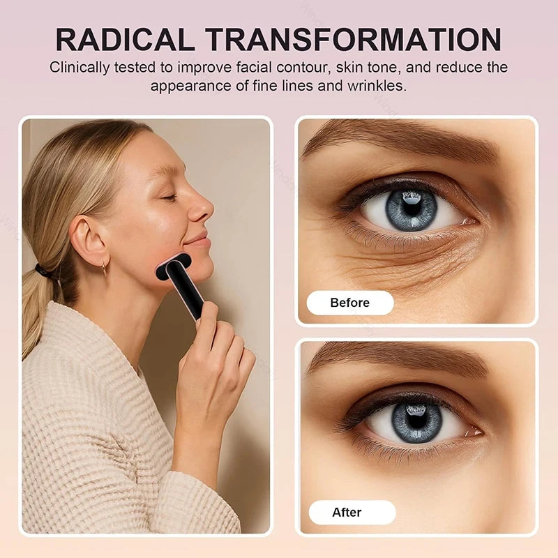 7-in-1 Facial Light Therapy Wand
